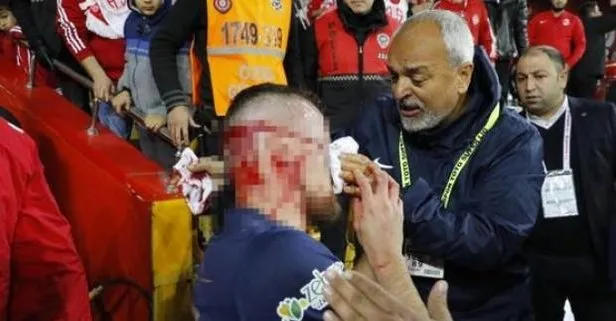Antalyaspor - Fenerbahçe maçında şok sakatlık!
