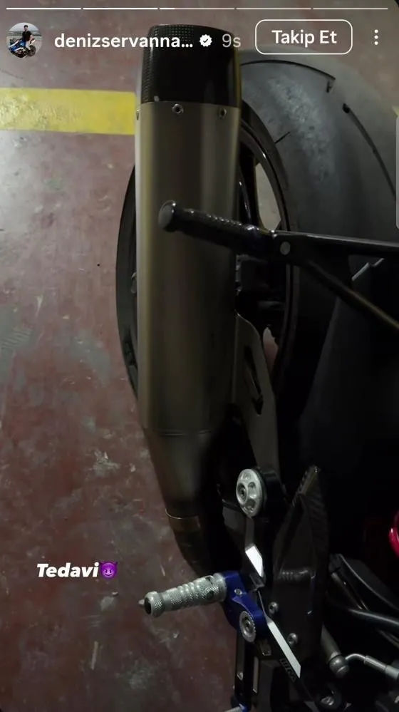 instagramda-17-milyon-takipcisi-vardi-unlu-motor-tutkunu-deniz-servan-narin-gecirdigi-kaza-sonrasi-hayatini-ka-1754843486221.jpeg
