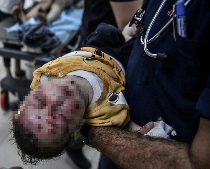 İşgalci İsrail Gazze'ye her saniye bomba yağdırıyor: 1 gecede 400 nokta 704 mazlum! | Hamas 2 rehineyi serbest bıraktı... Hastaneler çöktü-6