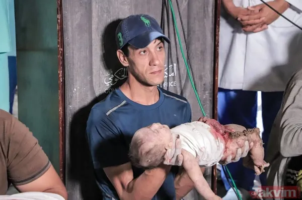 Dikkat!+18 | ABD'den soykırıma kalkan el! İşte işgalci İsrail'in Gazze'de uyguladığı katliamdan vahşet kareleri - 48