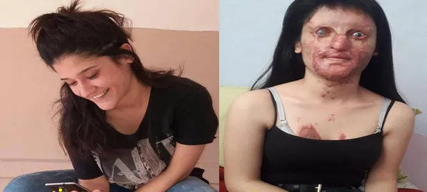 Berfin'in yüzüne asit türü sıvı atan sanık hakim karşısında-1