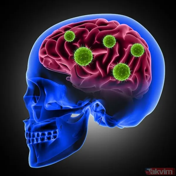 30 saniyelik el testiyle gizli beyin tümörü riski ortaya çıkabilir - 2