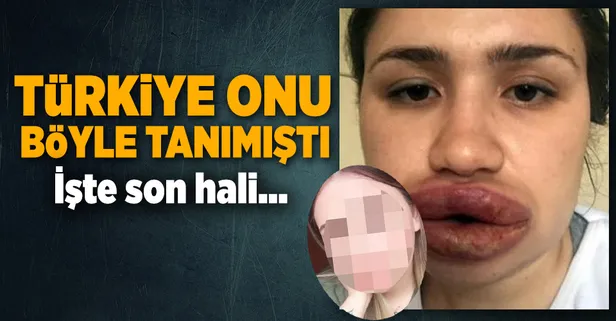 Türkiye onu böyle tanımıştı! İşte son hali