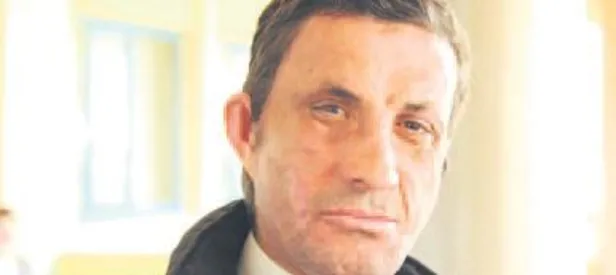 Yeni yüzüyle artist oluyor