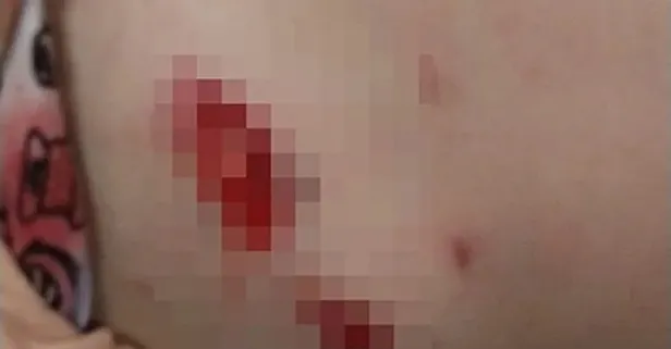 Bir başıboş köpek vakası da Ankara Gölbaşı'nda: 5 yaşındaki çocuğu sürükleyip yaraladı