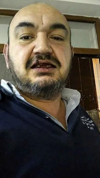 Sarıyer’de UBER sürücüsünü darp edip dişlerini kırdılar-1