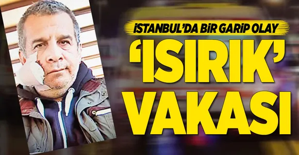 "Isırık" vakası