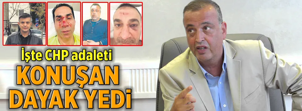 Konuşan dayak yedi