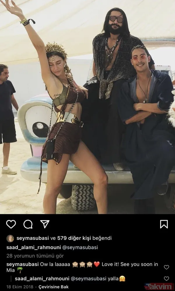 Acun Ilıcalı'nın yüzü gözü morluk içinde gören darp edildi sanıyor ama işin aslı başka! Estetik mi derken... - 36