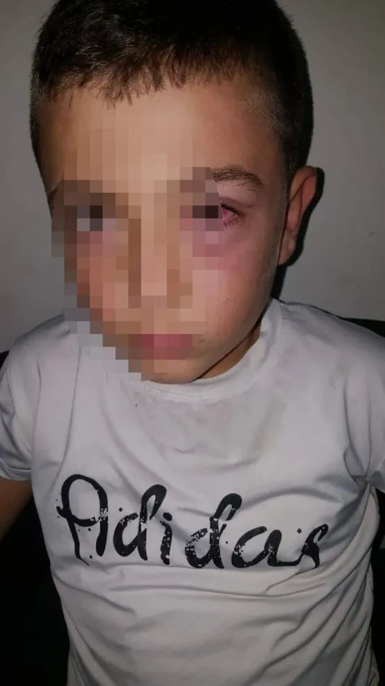 osmaniyede-9-yasindaki-cocugu-darp-etti-sebebi-saskina-cevirdi-1571503348124.jpeg Osmaniye'de 9 yaşındaki çocuğu darp etti! Sebebi şaşkına çevirdi...-1