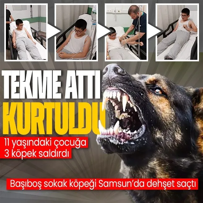 Samsun’da 11 yaşındaki çocuğa 3 başıboş köpek saldırdı!