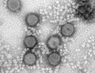 Çin’de yeni salgının ismi ’bunyavirüs’!