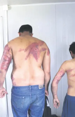 "İnsan hakları" nutukları atan Avrupa ırkçılığa sarıldı! Yunanistan'da mültecilere, İtalya'da Balotelli'ye saldırdılar