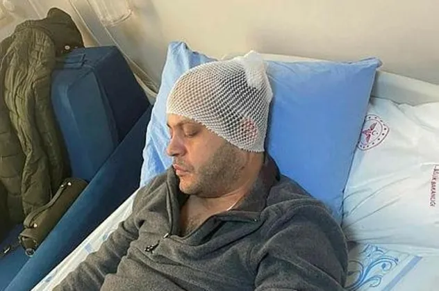 Kafasına mermerle öldüresiye vurulan doktora 8 dikiş atıldı! Yer: Gaziantep