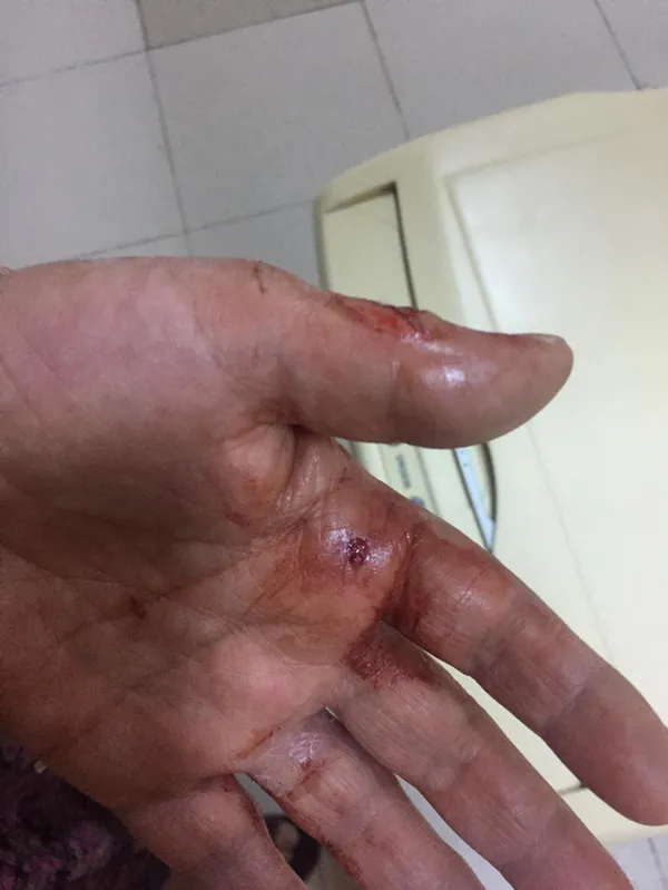 konusma-engelli-yasli-kadini-darbedip-2-bilezigini-calanlara-yardim-eden-kisi-komsu-kizi-cikti-1622035935588.jpg Konuşma engelli yaşlı kadını darbedip 2 bileziğini çalanlara yardım eden kişi komşu kızı çıktı-4