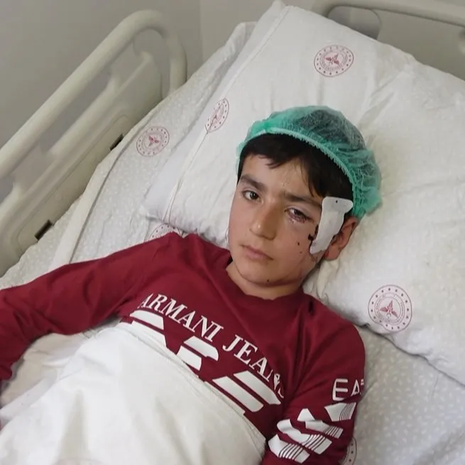 Koyun otlatan çocuk ölümle burun buruna geldi