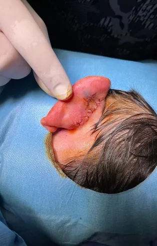 Başakşehir'de evinden otobüs durağına yürüyen Nazif Şenyiğit sokak köpeklerinin saldırısına uğradı