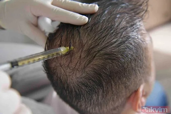 Bilim insanları tek yöntemle tarihe gömdü! Kelliğin dermanı sonunda bulundu! 40 yıl düşünsek aklımıza gelmez meğer... - 9