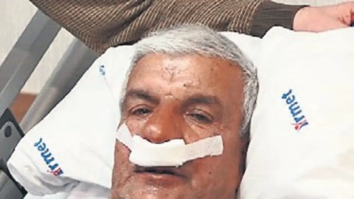 Burnundan taş çıktı: Burun tıkanıklığına dikkat!