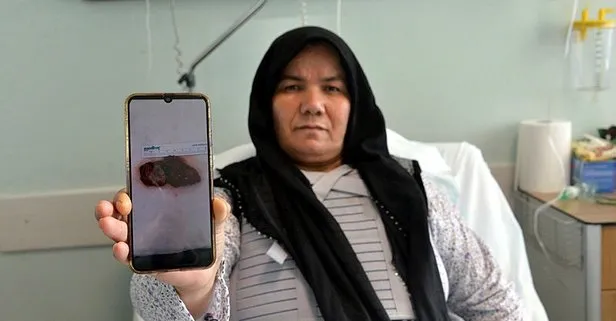 Kalbinden 7 santimetre büyüklüğünde çıktı!