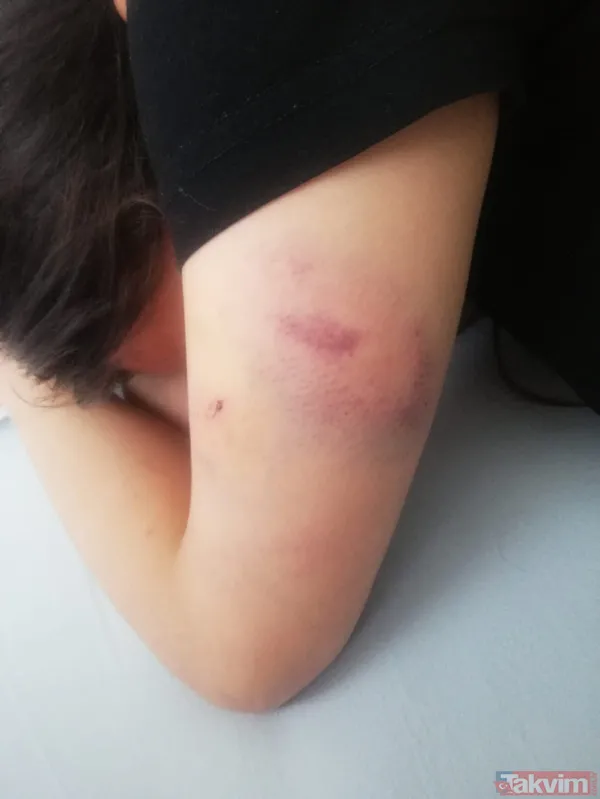 Konya'da iki kadın tarafından kaçırılıp işkence edilen Demet A dehşet anlarını anlattı! 'Evden çıkamayacağım sandım' - 11