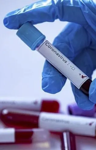 Son dakika: Sağlık Bakanlığı 27 Ocak koronavirüs vaka ve vefat sayılarını duyurdu | Koronavirüste son durum