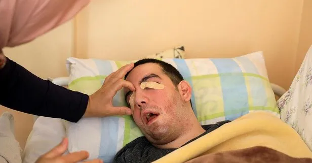 Anne Gülsüm Özçelik, yatalak oğlu Halil Özçelik’in gözlerini 6 yıldır yara bandıyla kapatıyor