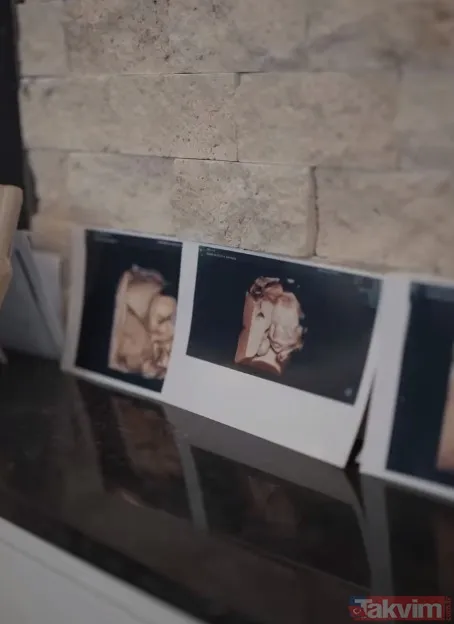 Mehmet Ali Erbil'in tacizini ifşa etmişti! Karnı burnunda olan Ece Ronay hem alttan hem üstten açtı o pozuna yorum yağdı: "Sen Rihanna mısın?" - 10