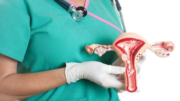 Çikolata kisti kısırlık nedeni: Yumurtalık kanserine yol açıyor-1