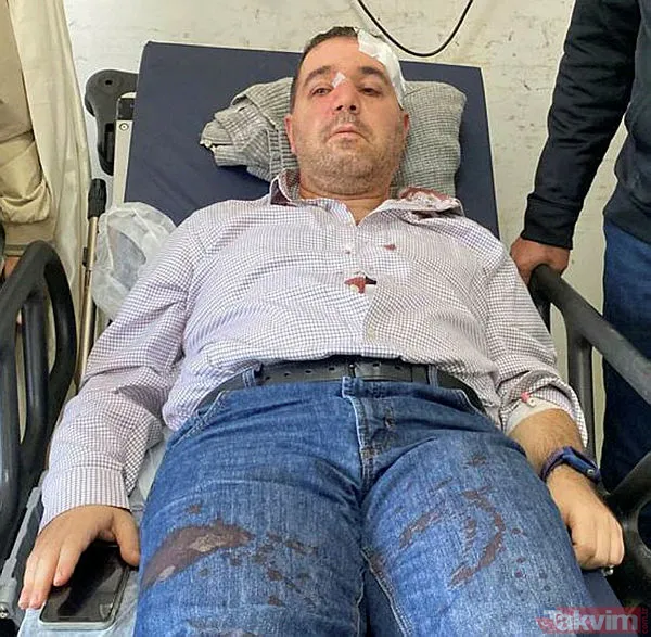 Yer: Sakarya Adapazarı... 'Beni taciz ediyorsun' diyerek saldırdığı doktorun burnunu kırdı! - 6