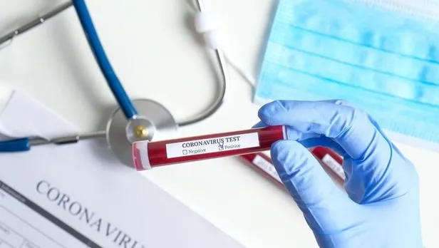 PCR testi ücretli mi ücretsiz mi? Devlet hastaneleri, özel hastanelerde PCR testi fiyatları ne kadar? Kimler yaptıracak?-2