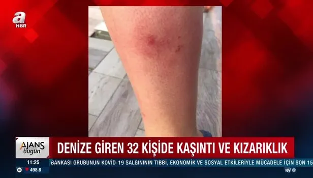 Sakarya Karasu son dakika! Denize giren 32 kişi hastanelik olmuştu! Nedeni belli oldu