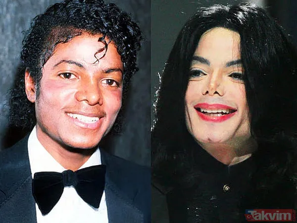 Bella Hadid ve Şeyma Subaşı'nın idolü Hailey Baldwin'in estetik açıklaması olay: Yüzüme asla dokunmadım! - 24