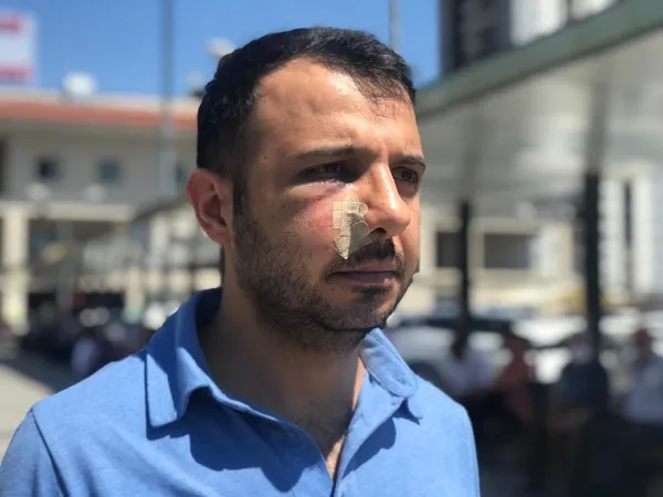 1657177685539.jpg Kimliksiz kayıt yaptırmak istedi! Kabul etmeyen sağlık çalışanını darp etti-2
