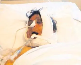 Yaşam savaşını kaybetti