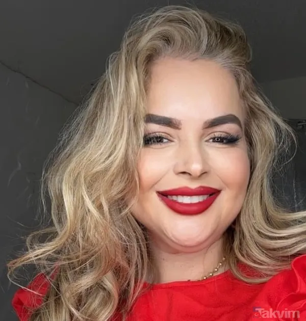 Midesi Kalbinin Arkasına Sıkıştı: Zayıflama Ameliyatı Hayatını Cehenneme Çevirdi - 2