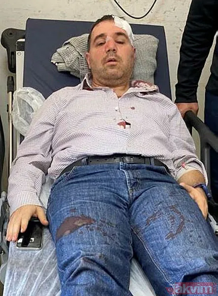 Yer: Sakarya Adapazarı... 'Beni taciz ediyorsun' diyerek saldırdığı doktorun burnunu kırdı! - 1