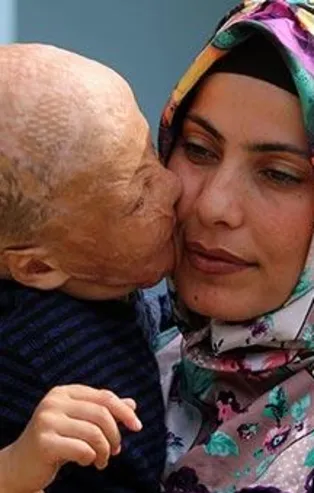 4 yaşındaki Halil Geyik'in ameliyatı için üç günde 200 bin lira!