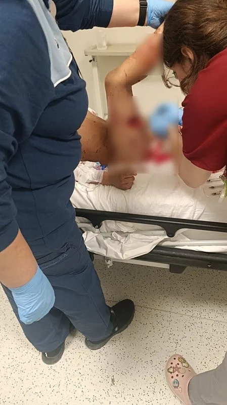 ankarada-basibos-kopek-faciasi-8-yasindaki-davut-elhamut-hastanelik-oldu-1767276537708.jpeg Ankara'da köpek saldırısına uğrayan 8 yaşındaki Davut hastaneye kaldırıldı (DHA)