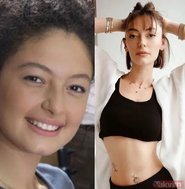 Esra Bilgiç estetik harikası çıktı! Eski halini görenin gözleri fal taşı gibi açıldı: Doğal sanıyordum! Diriliş Ertuğrul’un yıldızı... - 19