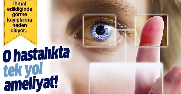 katarakt 40 yasini bekler katarakt