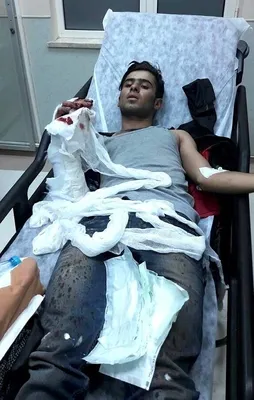 Polise atmak istediği EYP elinde patladı