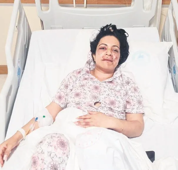 Onu affetmem imkansız! İstanbul'da eltilerin kavgasından kan aktı-2