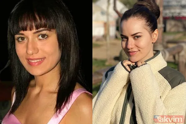 Şarkıcı Lara sonunda küçülttü! Estetikle bambaşka biri olan Lara paylaştı görenler 'yok artık' dedi - 18