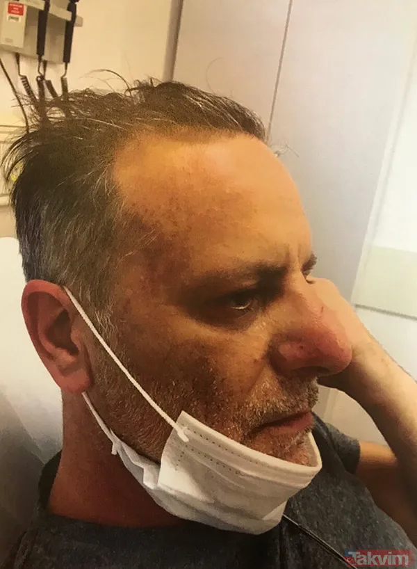 Savcılık Dosyasındaki Fotoğraflarda Olaya İlişkin Şiddet Gözler Önüne Serildi. Güven'in Uyguladığı Şiddete İlişkin Fotoğraflarda Bulutsuz'un Gözünde Morluk,...