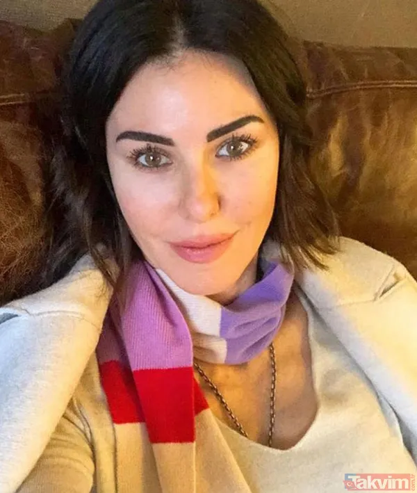 Neslihan Atagül'ün hızla kilo vermesinin nedeni geçirgen bağırsak sendromu çıktı! Neslihan Atagül'ün sağlık durumu nasıl? - 11