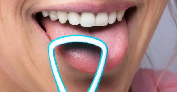 Uyandığınızda böyle oluyorsa doktora koşun: Dilinizin rengi hangi hastalığa sahip olduğunuzu ortaya koyuyor!