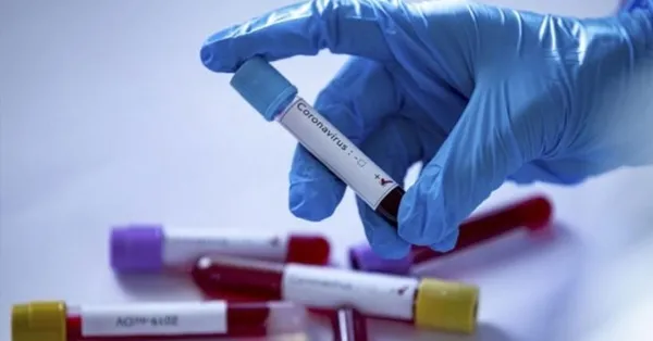 Koronavirüsün yeni mutasyonu iyi bir şey mi? Bilim insanlarından dikkat çeken açıklama!-7