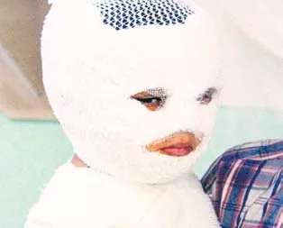 Süt kazanına düştü