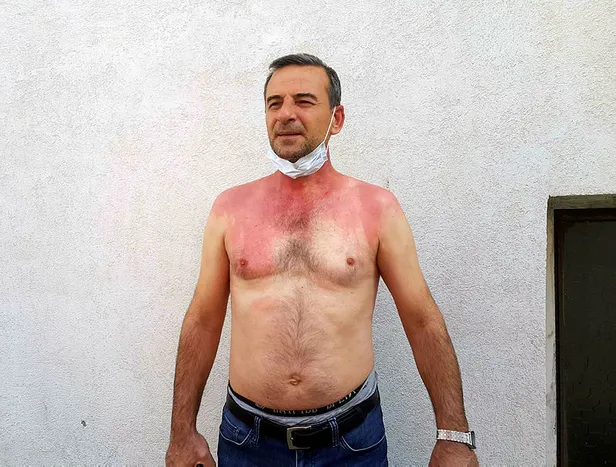 edirnede-dehset-komsusunun-uzerine-kaynar-su-doktu-1619939945030.jpg Edirne'de akıllara durgunluk veren olay: Komşusunu kaynar suyla haşladı!-3